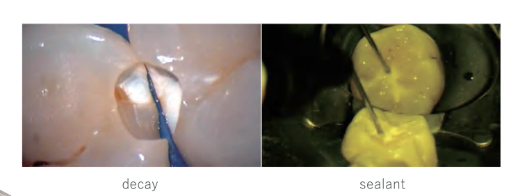 Image title